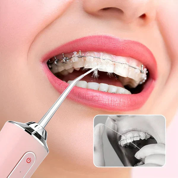 Električni Oralni Irigator za Zube